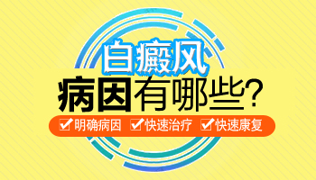 伍德灯检查早期白癜风