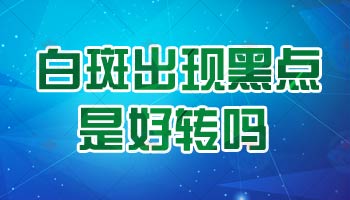 白癜风照308激光几天一次