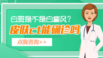 眼角出现白色的小块是不是白癜风