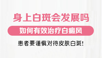 小孩有白癜风照射308激光间隔几天一次治疗