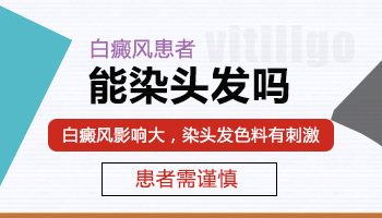 衡水身上长白癜风去哪个医院靠谱