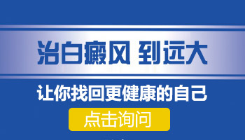 做什么检查能够查出白癜风的原因