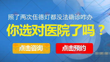 白癜风的饮食要注意什么?