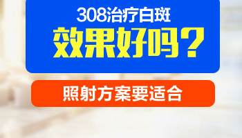 夏天白癜风照激光是不是剂量要调小一些