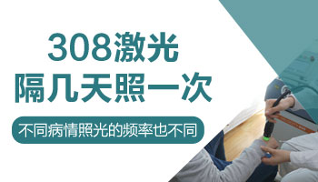 308激光照白癜风几天照一次合适