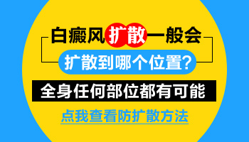 白癜风扩散一般会扩散到什么部位