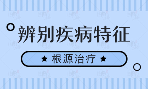 白癜风白斑发展期大概会维持多久