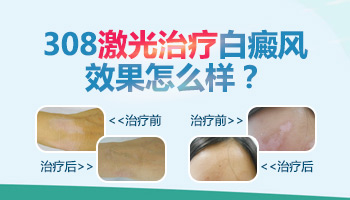 照完308激光白斑部位稍微有点红是怎么回事