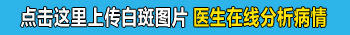 鼻子上长白斑是不是白癜风